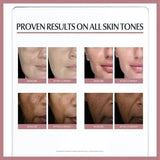 Even Pigment Perfector Dual Serum 30ml