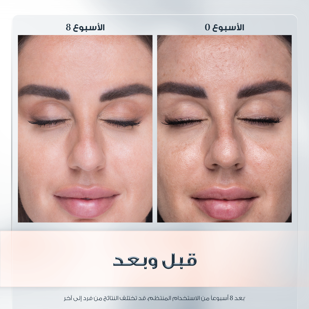 EUCERIN Eucerin Even Pigment Perfector Day 50ml EUCERIN Eucerin Even Pigment Perfector Day 50ml